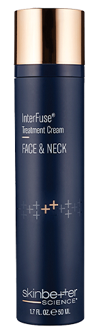 SB5016_InterFuseTreatmentCreamFACENECK50ML.fullsize.png